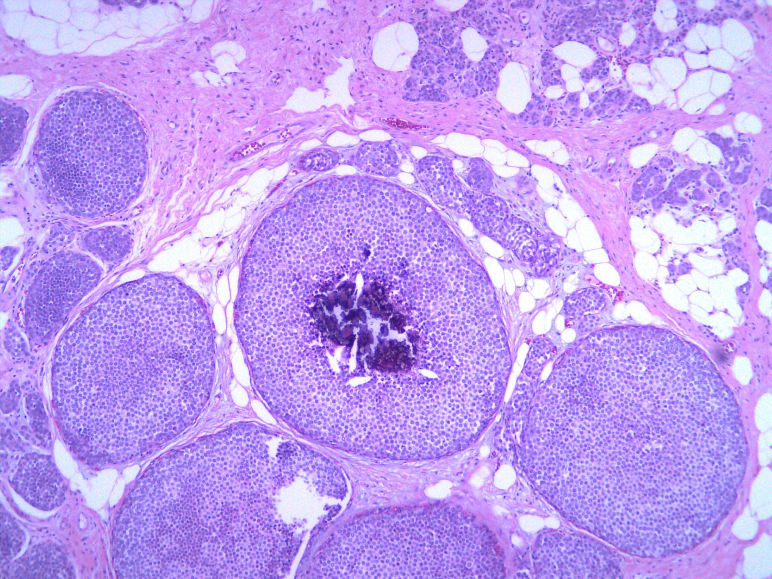 Breast and Gynecologic Pathology Breast and Gynecologic Pathology1