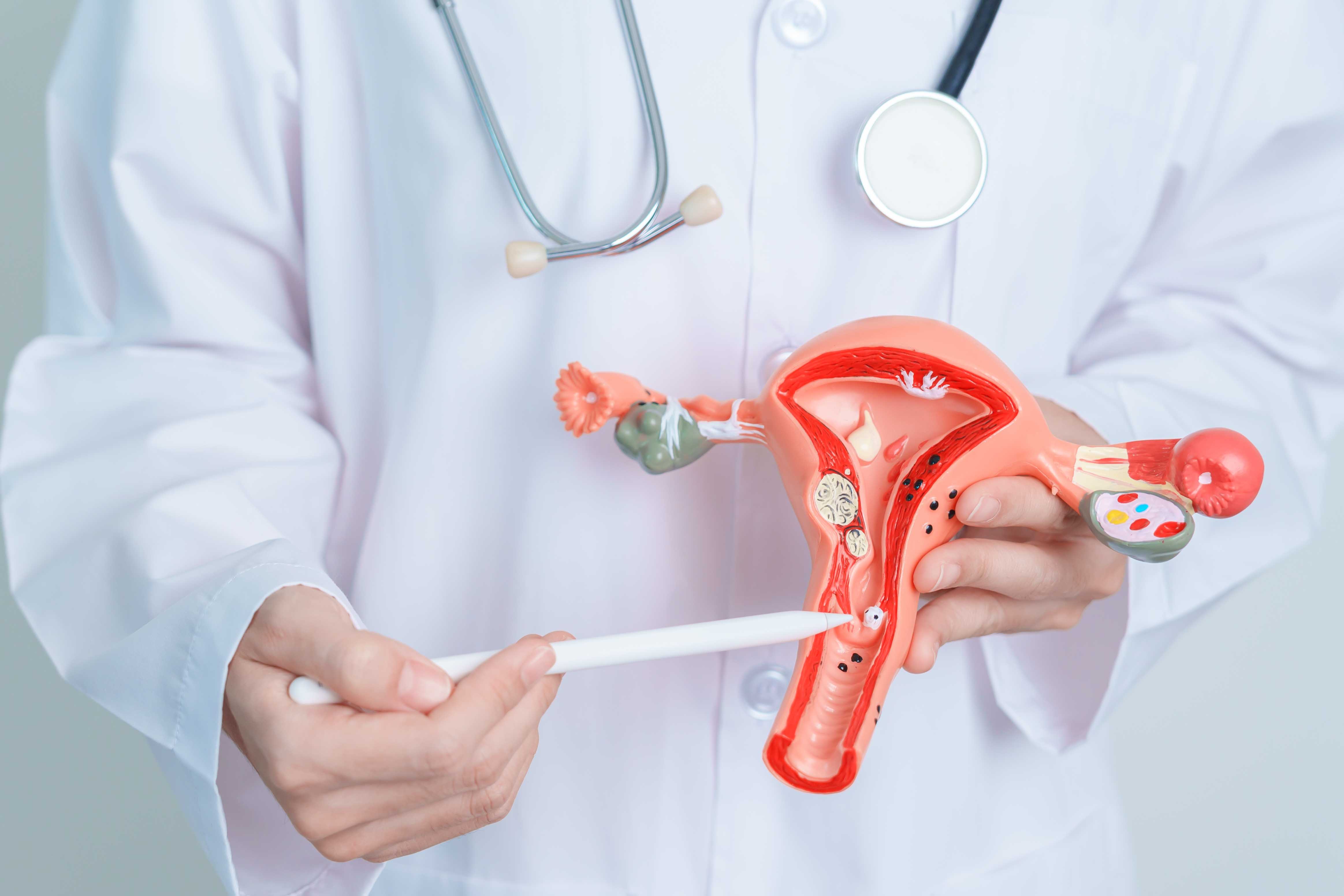 Gynecological Oncology1 Gynecological Oncology1