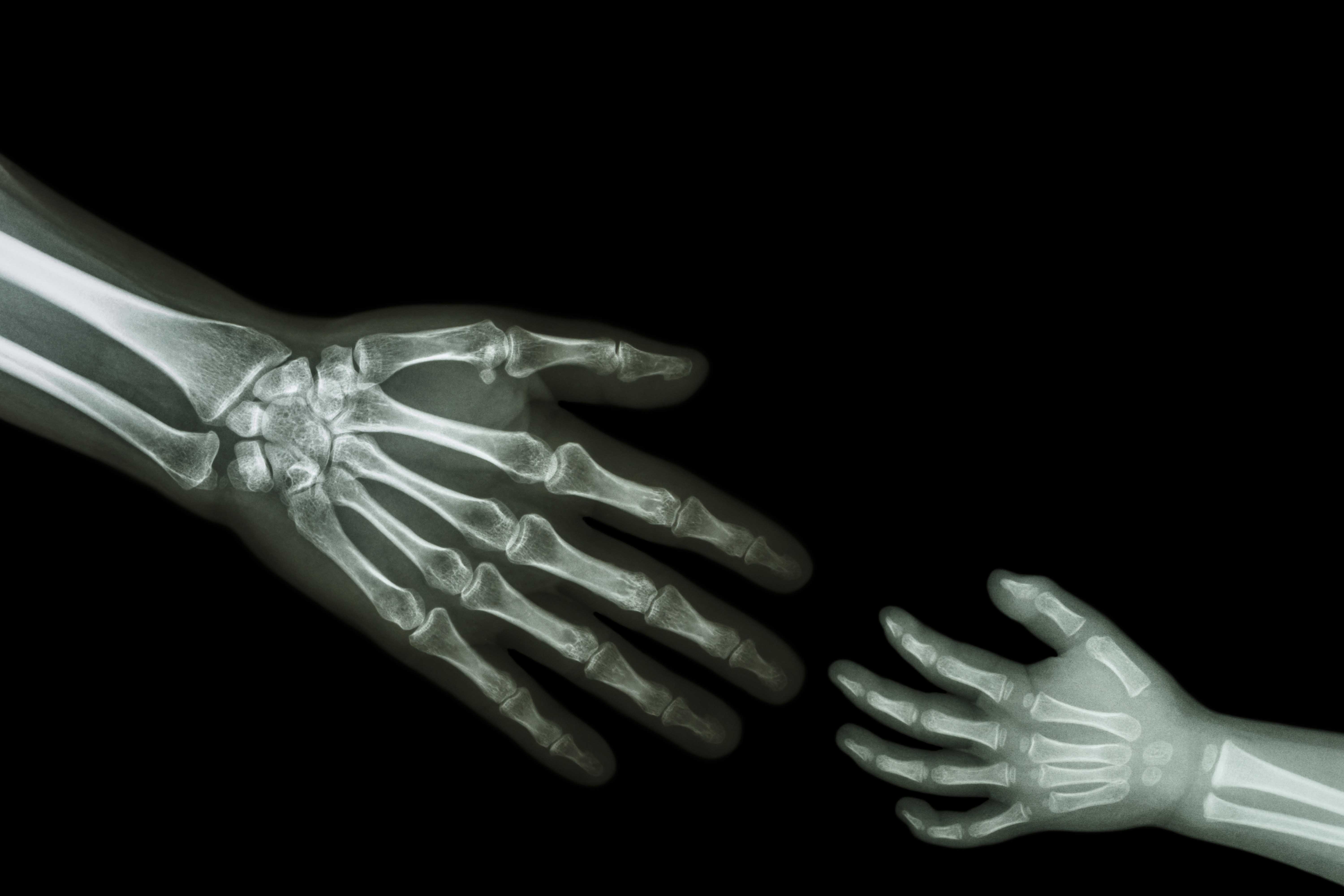 Pediatric Radiology Pediatric Radiology1