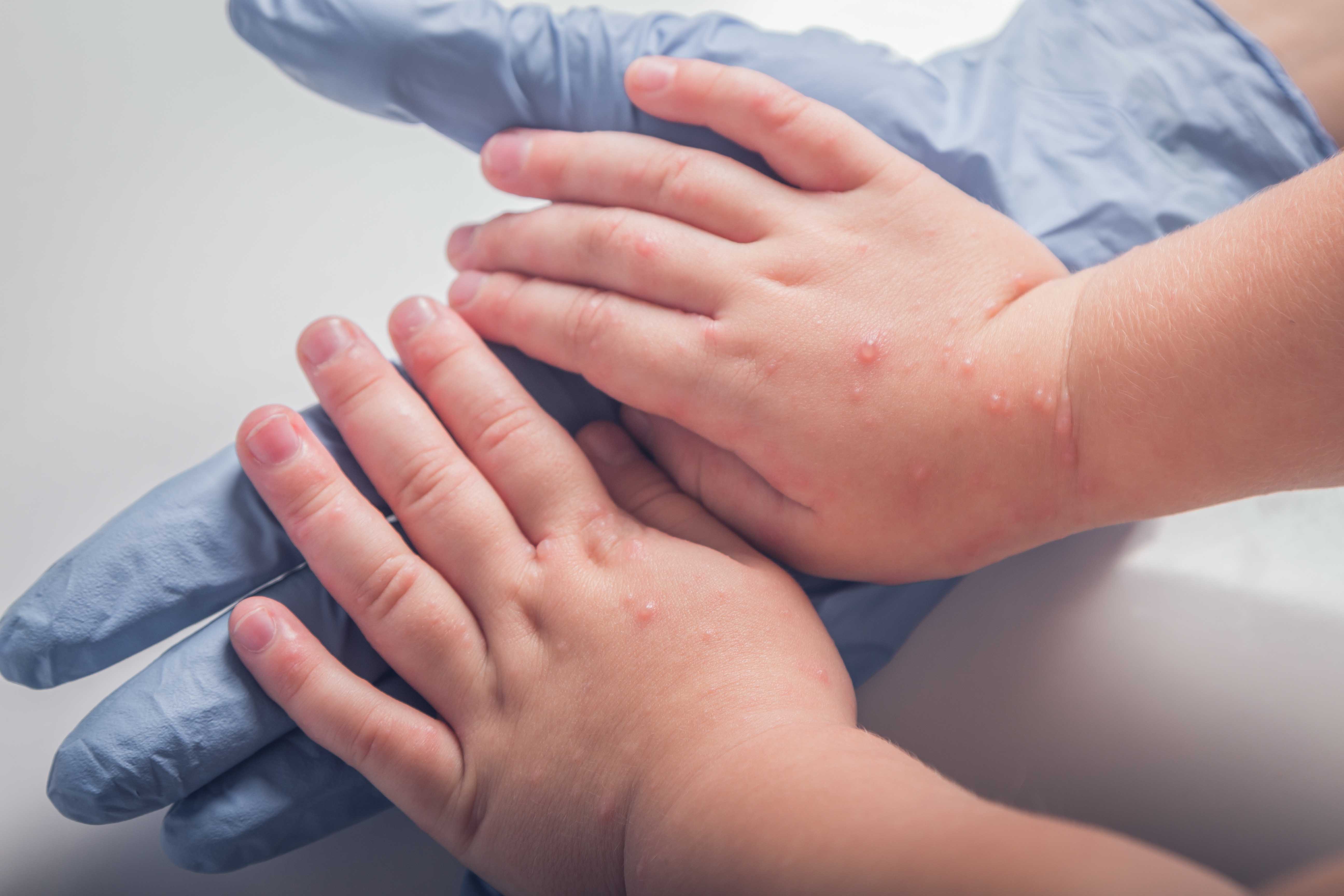 Pediatric Urology Pediatric Urology1