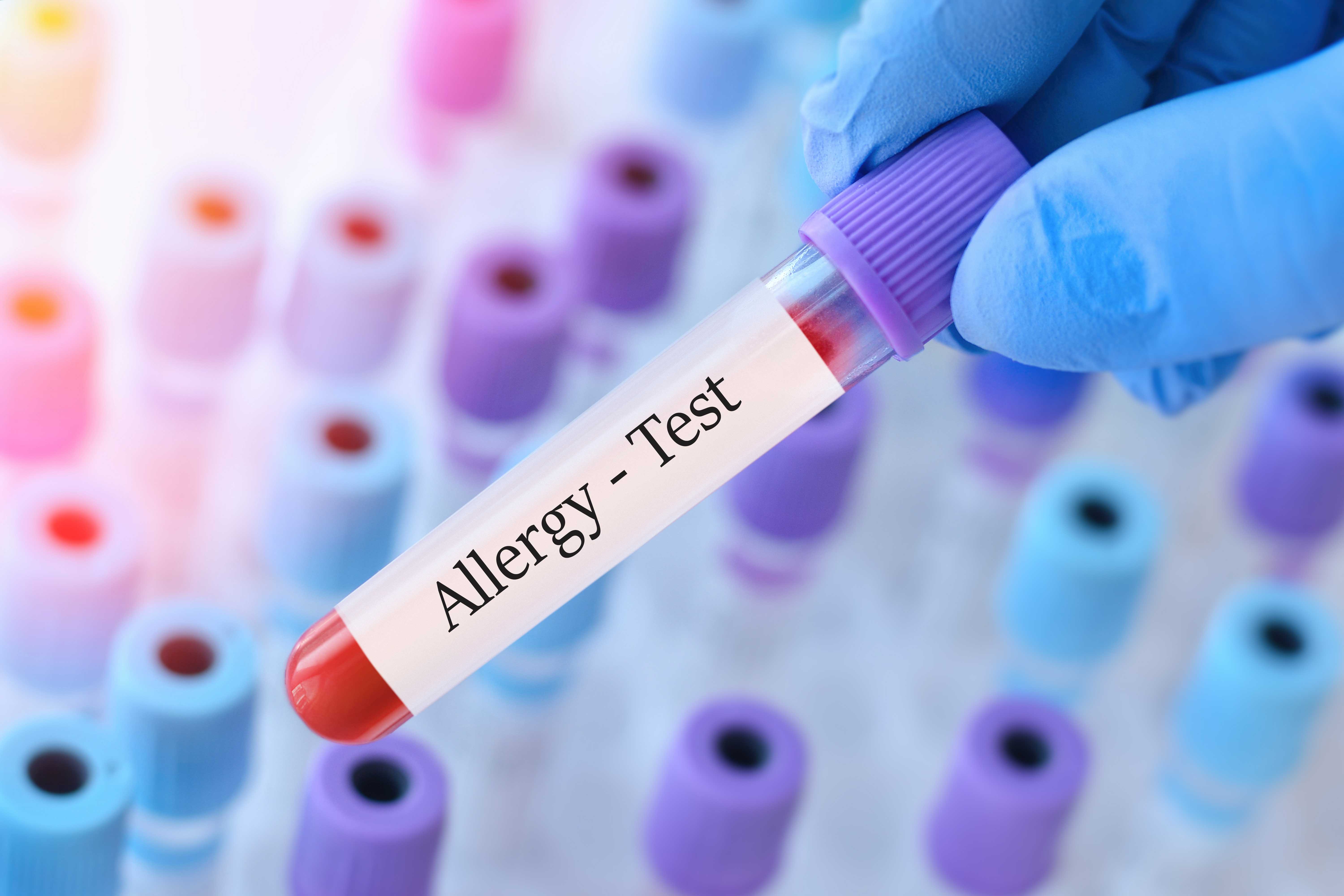 Allergy and Clinical Immunology Allergy and Clinical Immunology1