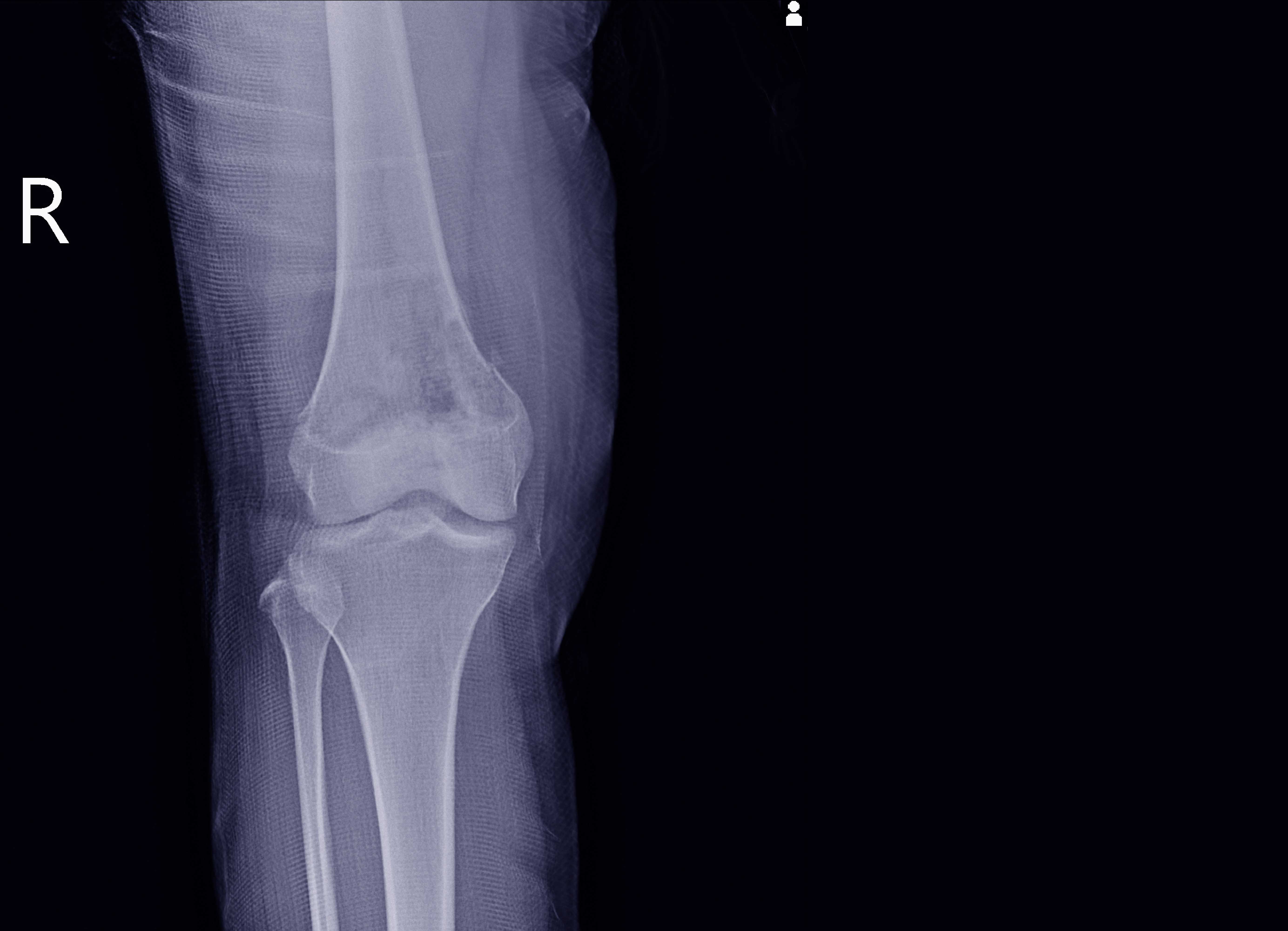 Bone and Soft Tissue Pathology1