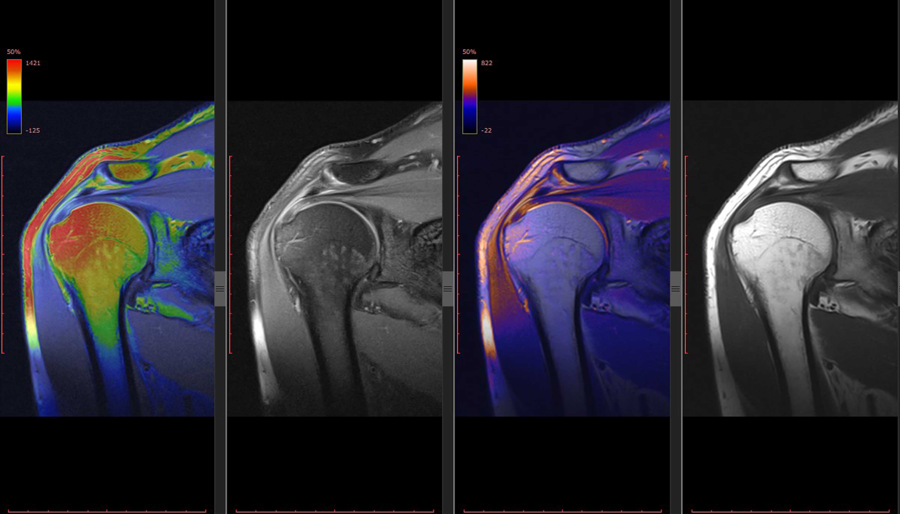 Musculoskeletal Imaging1