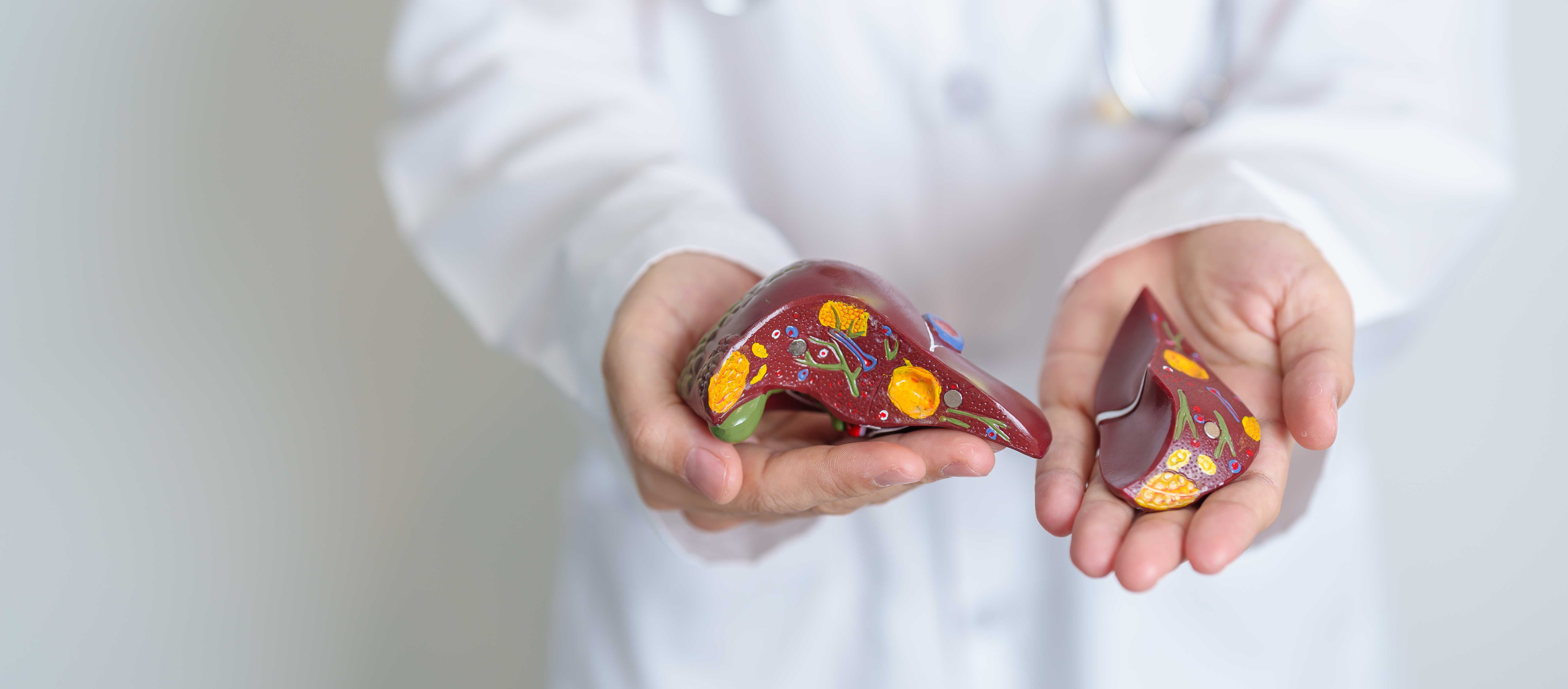 Transplant Hepatology1