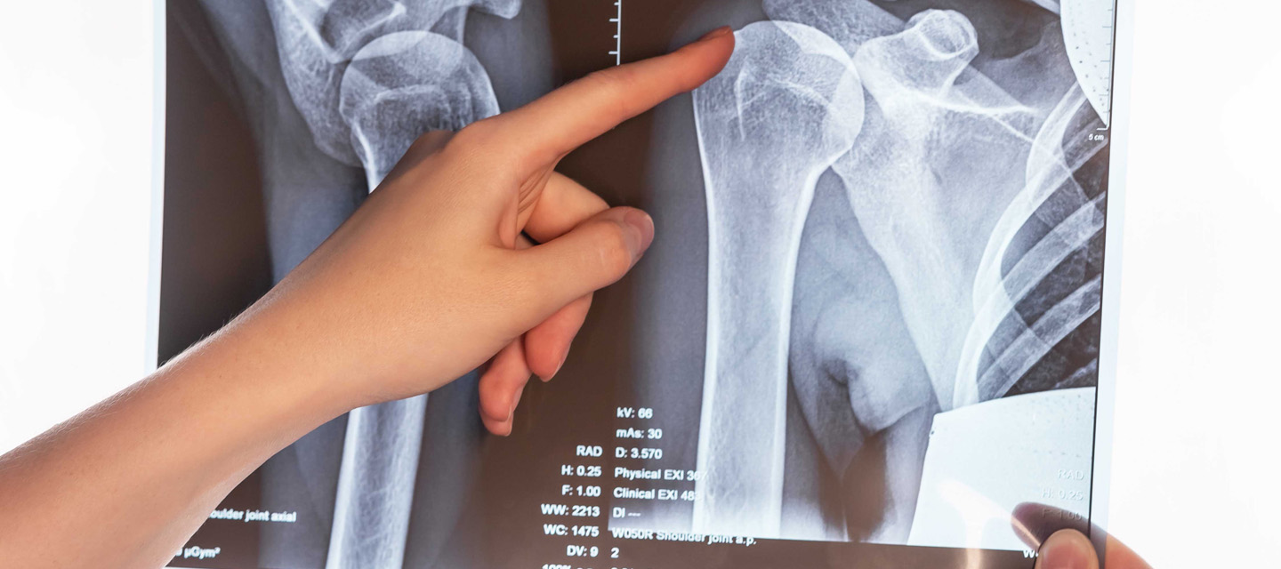 Musculoskeletal Imaging and Interventions1