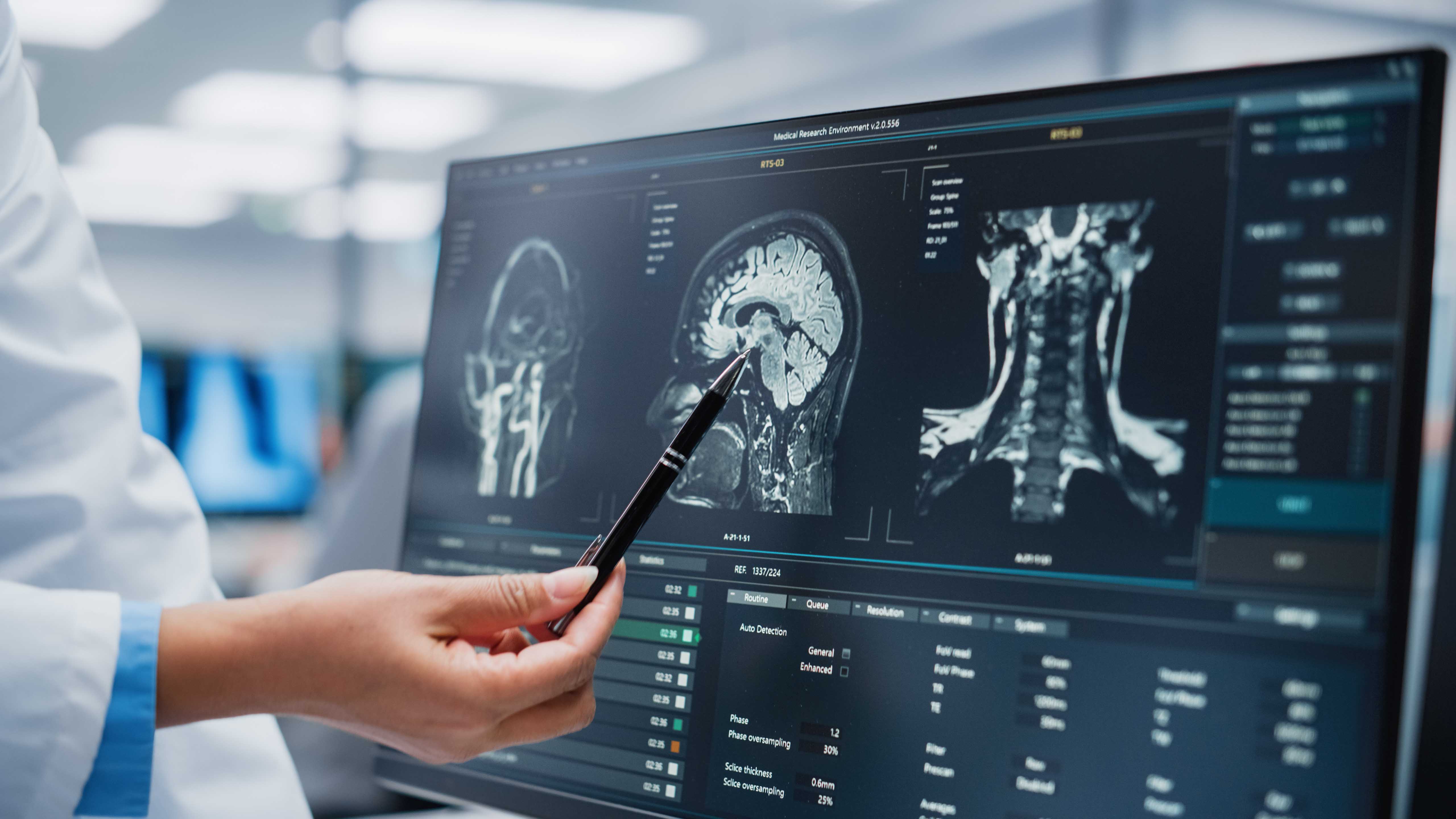 Neurosciences  Neuroscience j1