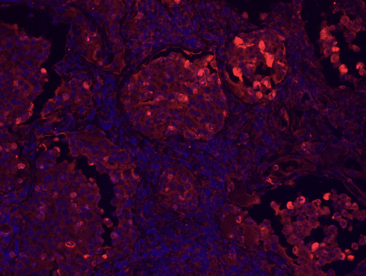 Figure01  Trastuzumab deruxtecan TDXd