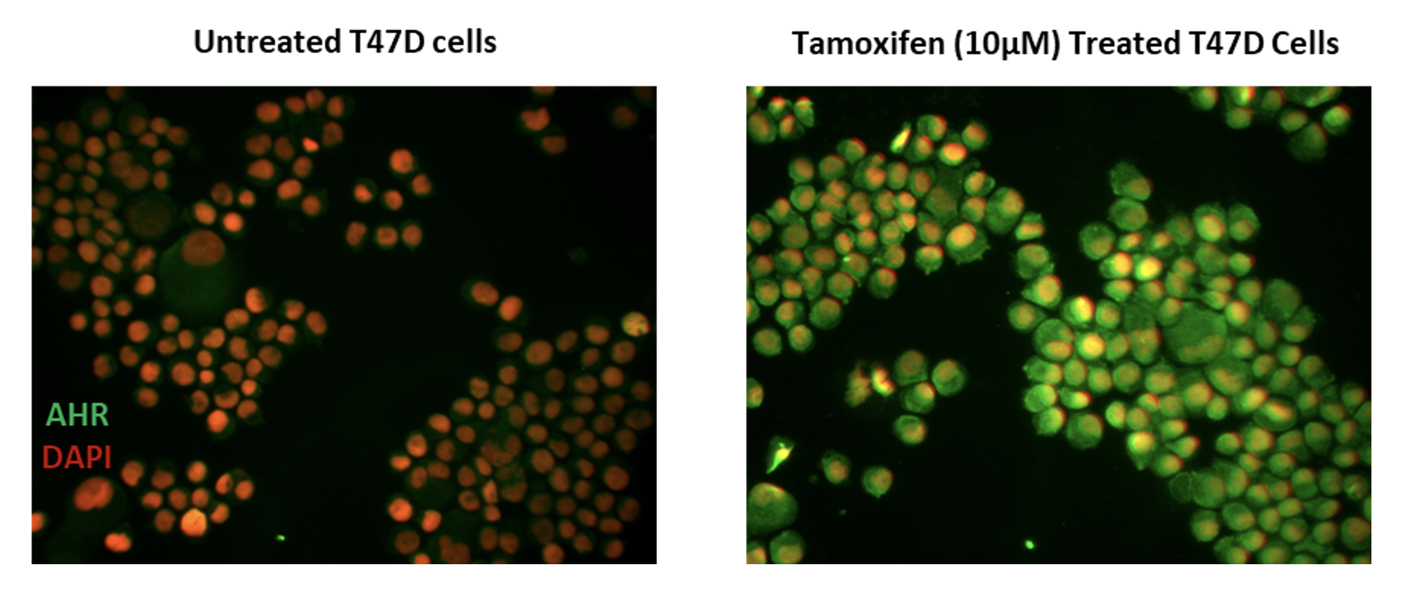 Figure01 Antitumor Pharmacology of Aryl Hydrocarbon Receptor AHR Full Antagonist Against Solid Tumor