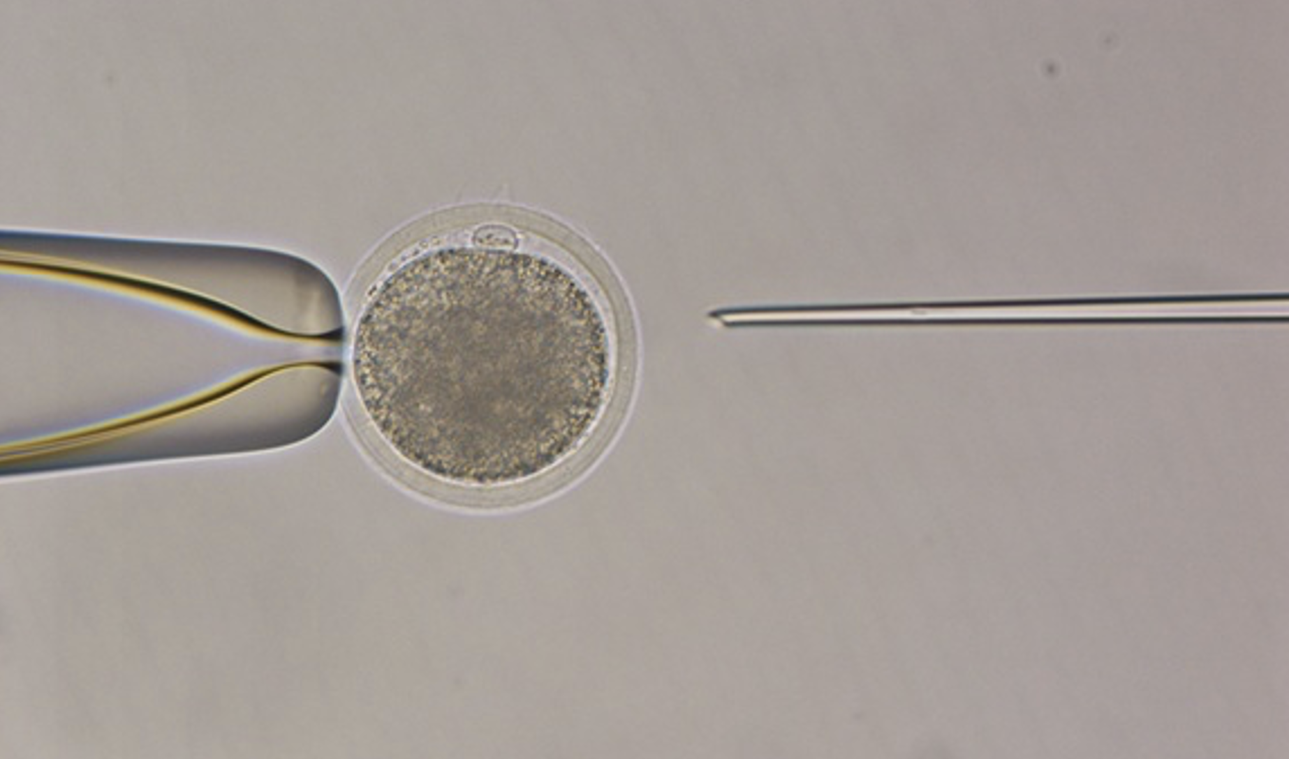 Figure01 Investigating the protective and ameliorative effects of cord bloodderived exosomes on oocy