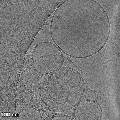 Reprotoxic Immunosuppressants and Female Fertility