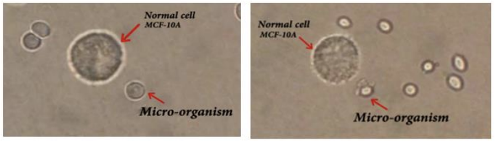 Figure02 Extraction of bioactive proteins and peptides from microorganisms